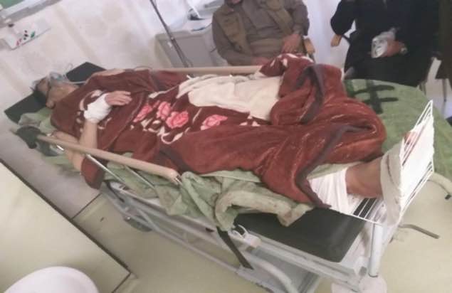 A Civilian Lost his Leg Due to Mine Explosion in Kurdistan