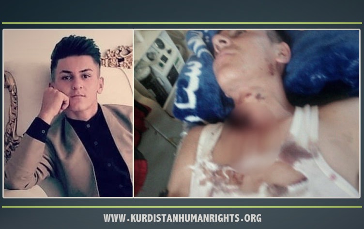 مریوان؛ زخمی شدن یک کودک کولبر با تیراندازی ماموران مرزبانی ایران