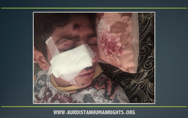 نوسود؛ ضرب و شتم یک کودک کولبر توسط نیروهای مرزبانی ایران