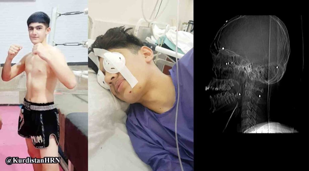 Young protester shot by Iran forces loses sight in one eye
