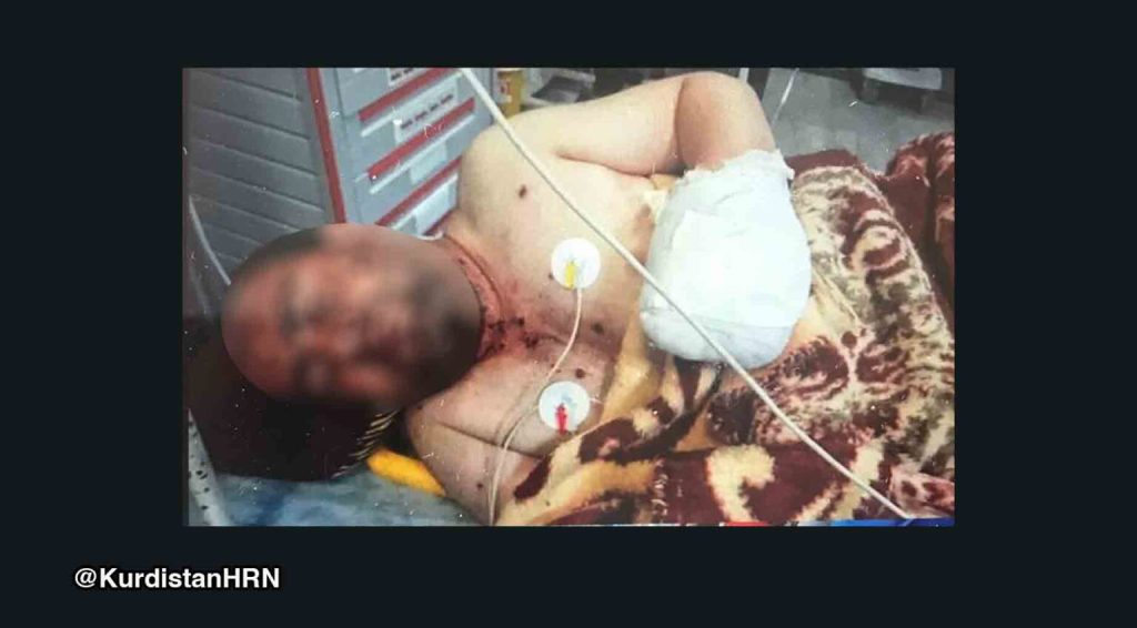Landmine blast severely injures civilian in Iran’s Qasr-e Shirin