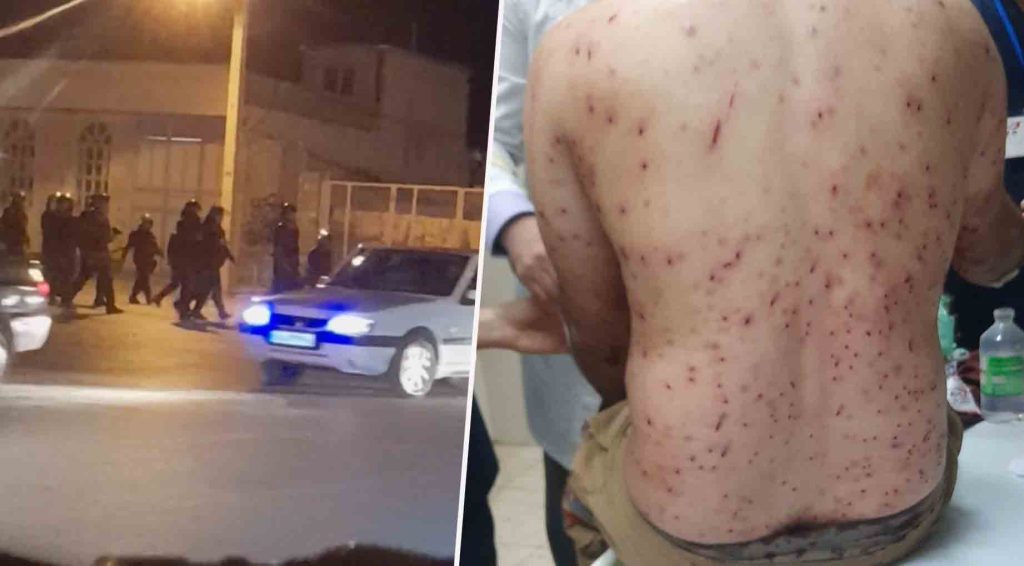 آبدانان؛ مجروح شدن بیش از ۲۰ شهروند معترض/ ادامه جو نظامی-امنیتی در این شهر