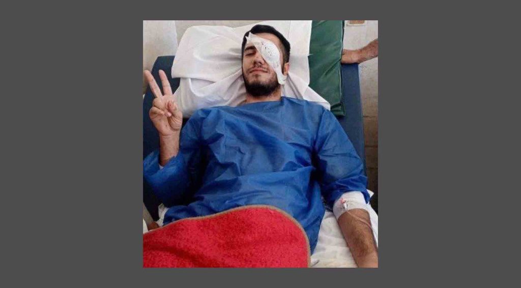 صادق محمودنژاد، معترض آسیب‌دیده از ناحیه چشم به حبس محکوم شد