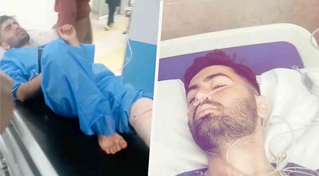 Kolbar shot by Iran border guards undergoes leg amputation