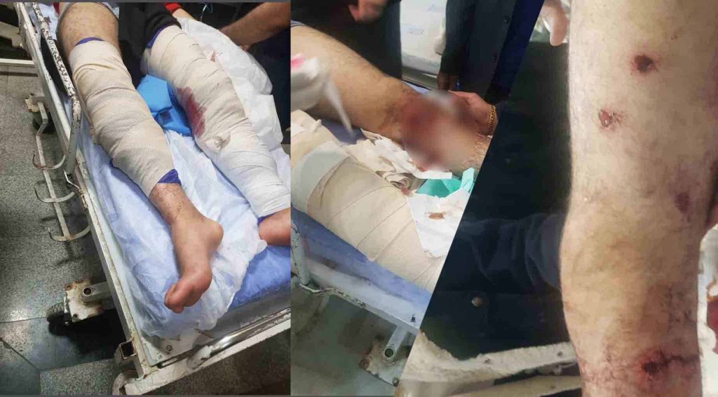 Security forces’ gunfire wounds two young men in Kermanshah